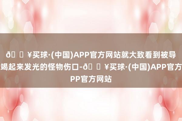 🔥买球·(中国)APP官方网站就大致看到被导虫不竭起来发光的怪物伤口-🔥买球·(中国)APP官方网站